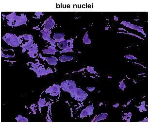 Step 6: Segment the nuclei into a separate image with the L* feature In cluster 1, there are dark and light blue objects (pixels).