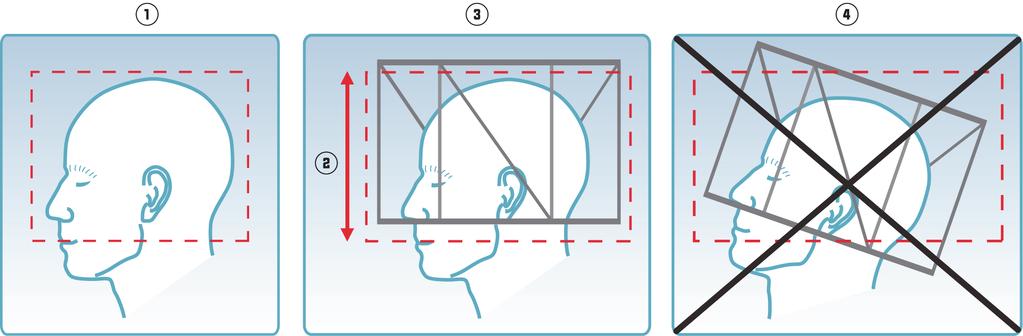 Cranial D protocol Minimize the angle between the vertical localizer rods and the superior-inferior image axis.