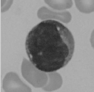 Segmentation of White Blood Cell using K-Means and Gram-Schmidt Orthogonalization Using this method, for