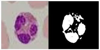 Initially the input image is required filter and normalization. (a)input image e. RBC and cytoplasm f.