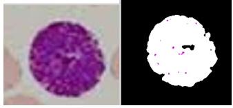 J. Puttmade Gowda and S. C. Prasanna Kumar Table 1. Accuracy Rate Test Image Existing proposed Accuracy (%) Neutrophil 0.9405 0.9523 95.23 Eosinophil 0.9081 0.9257 92.57 Basophil 0.947 0.9674 96.