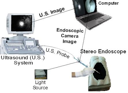 Use of Ultrasound and Computer Vision for 3D Reconstruction 783 We extent a previously proposed method [4] which used just monocular endoscopic images to calculate the pose (i.e. the position and orientation) of the USP.