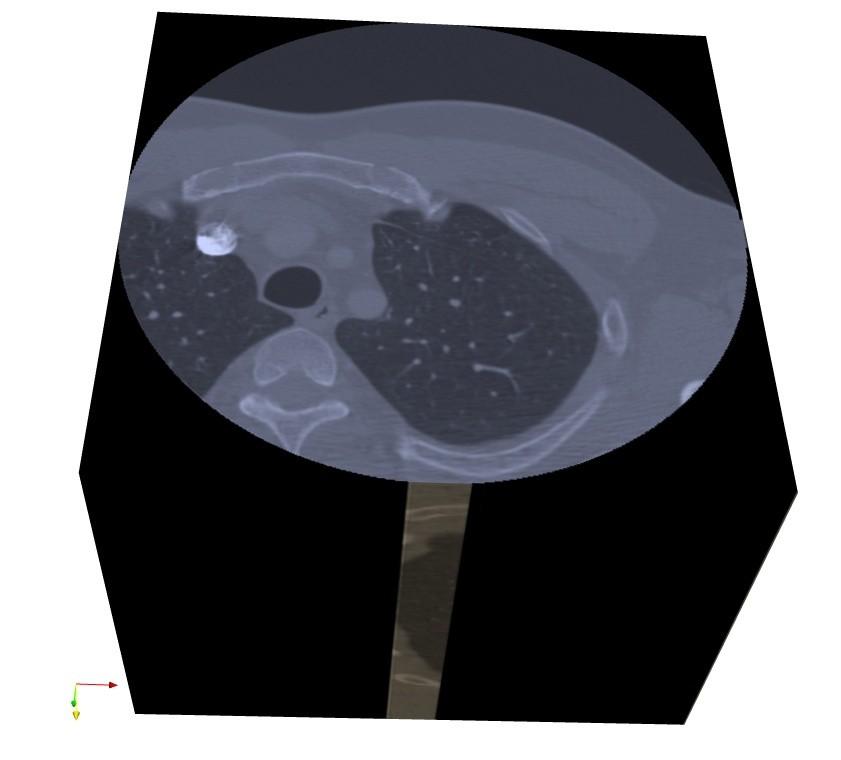 Results 3D CT