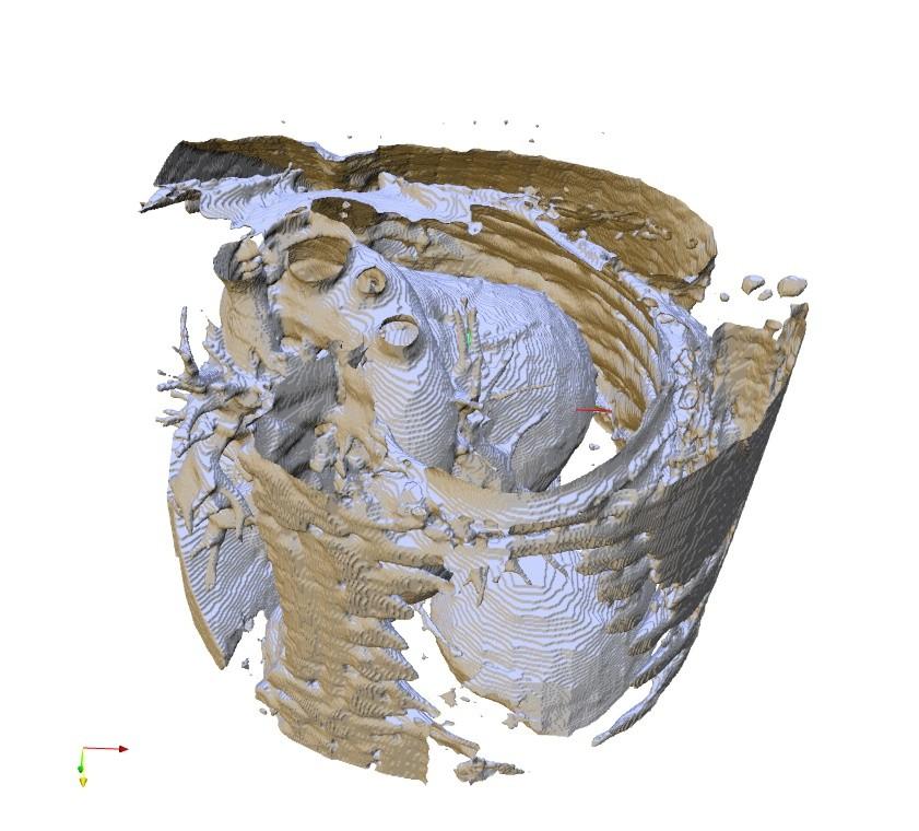 Results 3D CT