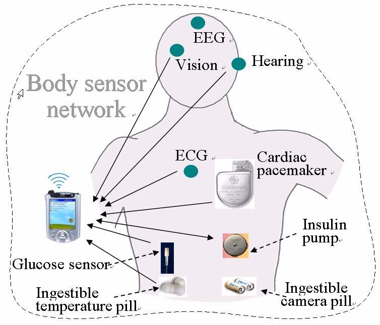 An Ultra-low-power Medium Access Control Protocol for Body Sensor Network Huaming Li and Jindong Tan Department of Electrical and Computer Engineering Michigan Technological University Houghton, MI