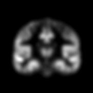 aligned grey and white matter maps.