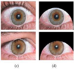 occluded by upper eyelid. Figure 5.