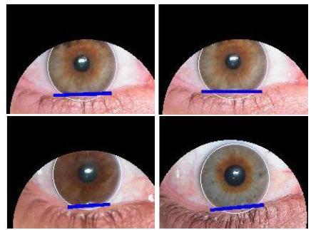 133 5.5.5 Lower Eyelid Localization To localize the lower eyelid of the iris, we use the Line Hough transform, because most of the occlusions of the lower eyelid are approximately linear. Figure 5.