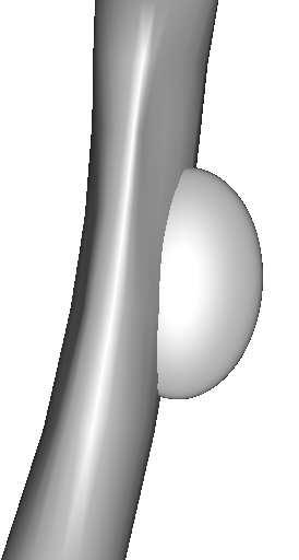 6 s = s =.2 s =.4 s =.6 s =.8 s =. Fig. 3. Different synthetic objects created with one deformed tube and one ellipsoide as a function of the ellipsoid s.