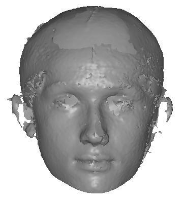Figure 93 shows the corresponding faces exhibiting the minimum and maximum asymmetry in the sample. Figure 93: Shows the face with the minimum facial asymmetry (0.