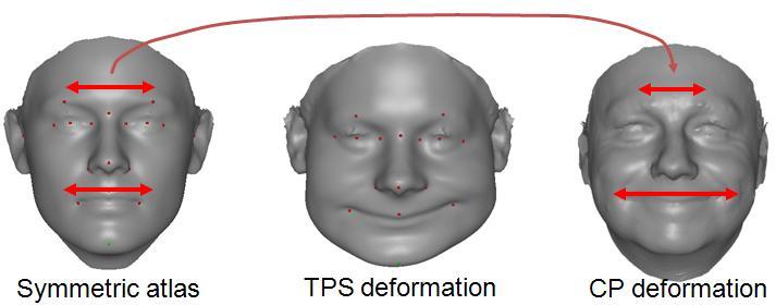 Chapter 4 Figure 15 illustrates this type of non-rigid deformation where a symmetric template (also called atlas) is deformed first by TPS, then by CP deformation.