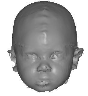 2 Material The material consisted of 10 3D surface scans of normal African American boys of various ages (some of them are seen in Figure 40).