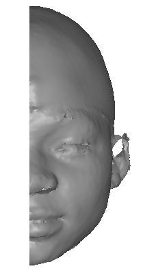 Finally the Face Analyzer software carries out an orientation (ORIENT), matching (MATCH) and asymmetry quantification (ASY) for each face surface scan to be analyzed. 6.3.