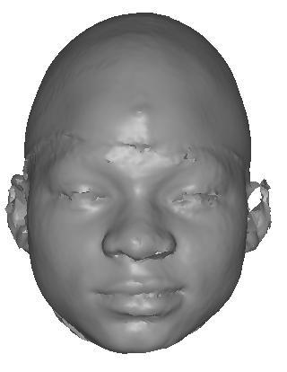 x-, y- and z- directions correspond to the transverse, vertical and sagittal directions in the face, respectively. The face is cut along the MSP and one half is saved.