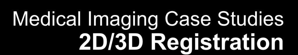 Medical Imaging Case Studies 2D/3D Registration 100x RapidMind implementation runs over