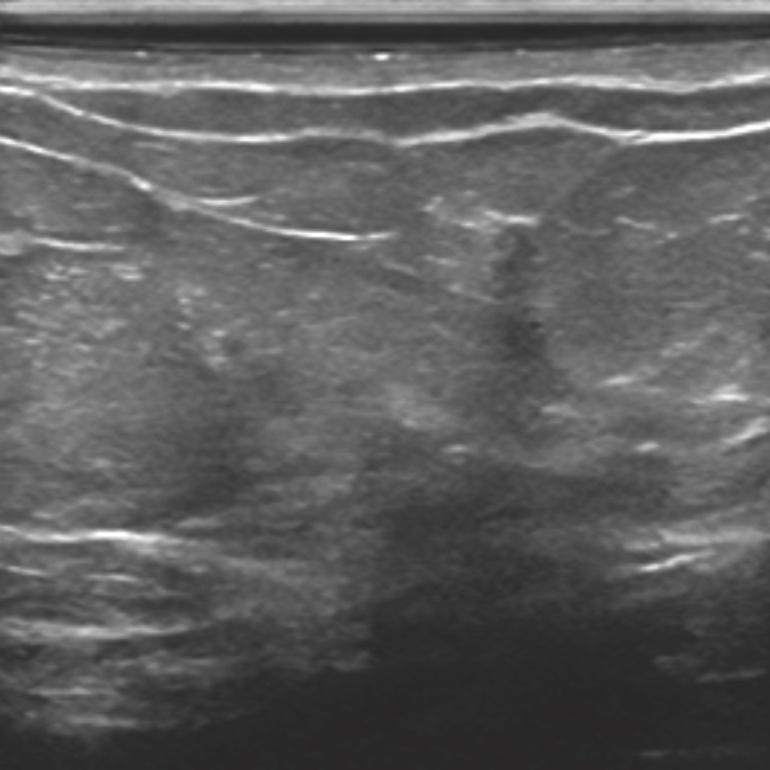 award-winning flagship B-CAD solution helps characterize, evaluate, and document breast ultrasound images in