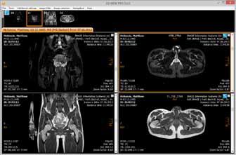 Bring all views to the same anatomic position by browsing through the series.