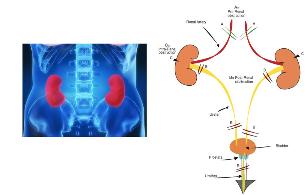 contexts and background kidney exchange