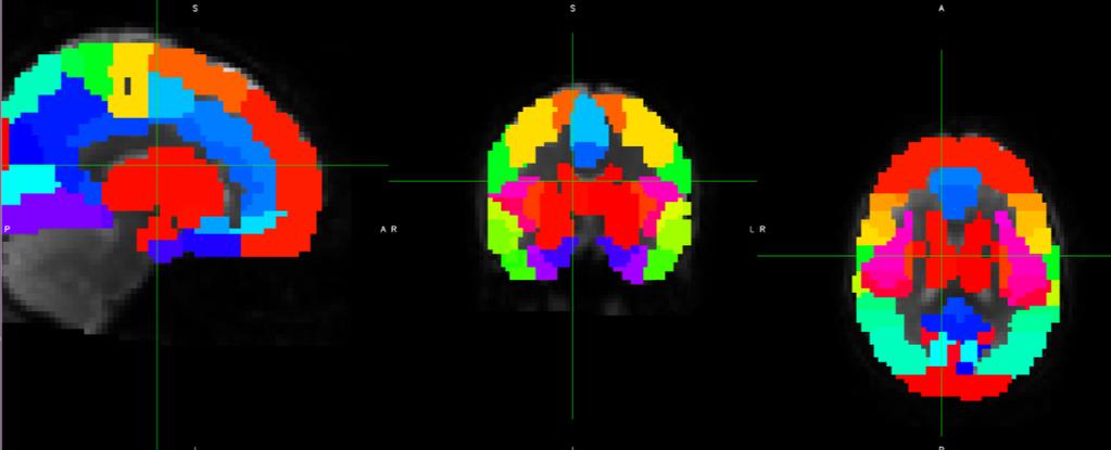 non-preprocessed brain scan [35].