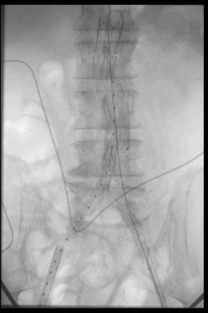 Vascular & interventional radiology