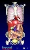 Section 4: APPENDIX Description of clinical cases available for all users Visible Patient directory vpatient01-body: 3D modeling from a