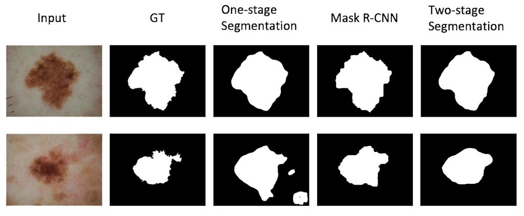 Figure 9: Predicted masks of different segmentation methods 2.6 Implementation The detection part of our method is implemented by using Pytorch 0.4 in Ubuntu 14.04.