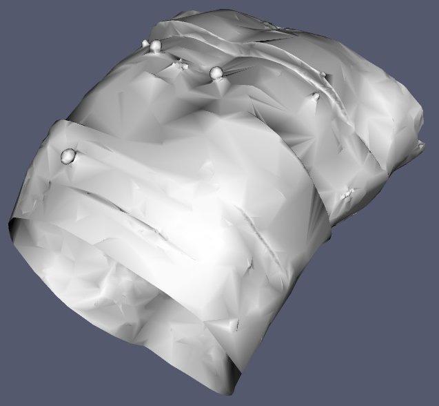 4 Patient 3D Model Generation from DICOM-RT CT An important issue we address in this project is the inclusion of real patient data in the simulation.