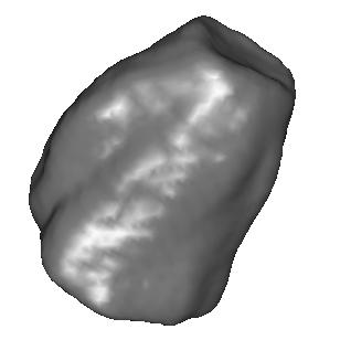d) Planar view of the same slice, intersection with the model evolved as a level set. e) final segmentation after a few iterations of the level set.