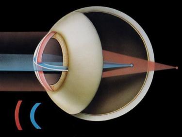 Iris (Diaphram) located at the of the eye. Pupil the in the center of the eye. The size of the hole is controlled by the.