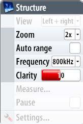 Changing the StructureScan image Zooming You can select different zooming levels on the StructureScan image. By default the zoom level is set to Off.