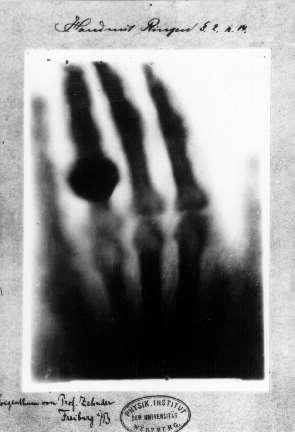 An x-ray radiograph
