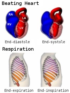 It also models common motions in the human body, such as cardiac and respiratory motions.