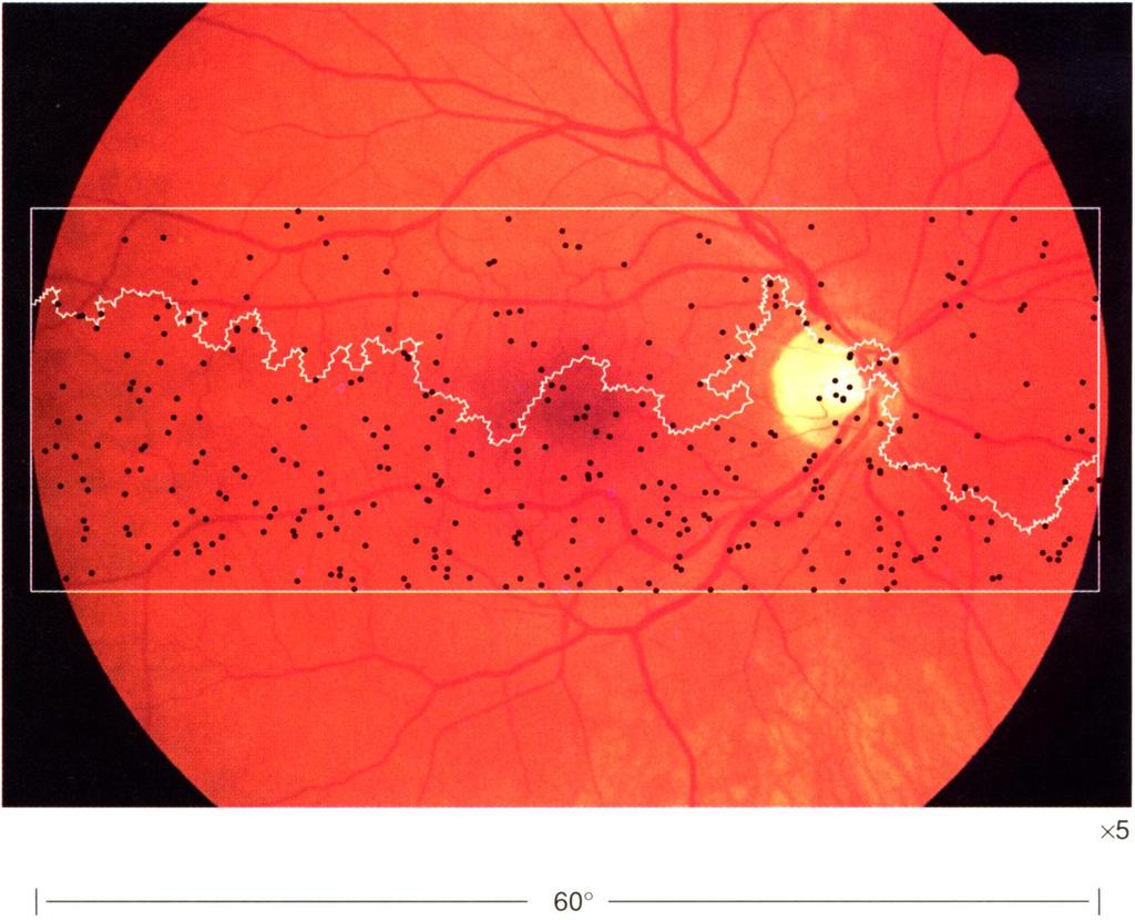 Scotopic Vision: rods and night vision from Rodeick, 1998