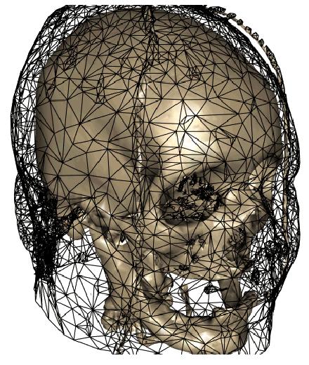 Figure 3: Reconstructed skull surface and overlaid triangulation of the skin surface obtained from CT data set. The model is 3-dimensional and may be viewed from any direction. 1.