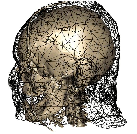This 2D feature-based alignment is based on a concept of saliency, aligning sections of high variability in the skull images. 2. The second stage of morphing is depth adjustment, in which a depth offset δ r is added at each pixel, based on fitting an interpolating surface.