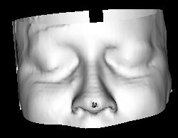 Figure 8: The morphing process is demonstrated with two scanned heads taken from the CT data base.