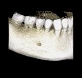 D0010759 3(5) Resolution modes Mode Endodontic High resolution HD Normal Low