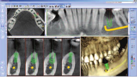 Left and right TMJ are available in one view for easy comparison.