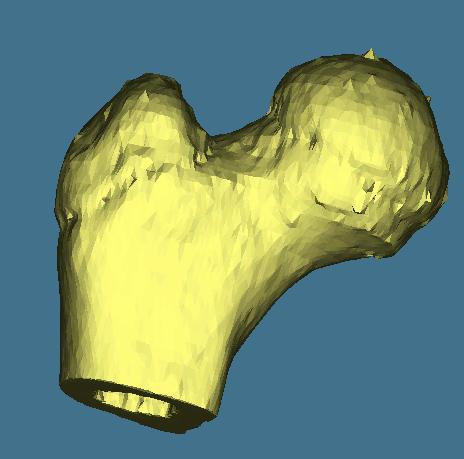 433 was identified and a 3D voxel model of the bone under study made. As a first step, an appropriate threshold range was found that could best capture the relevant information contained in the femur.