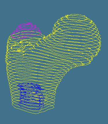 CT/MRI data a) Polylines contours used to demarcate