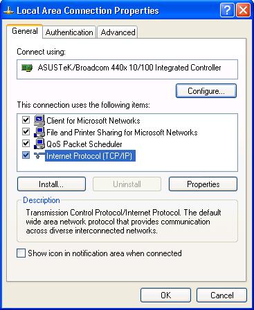 In the Local Area Connection Status window, click