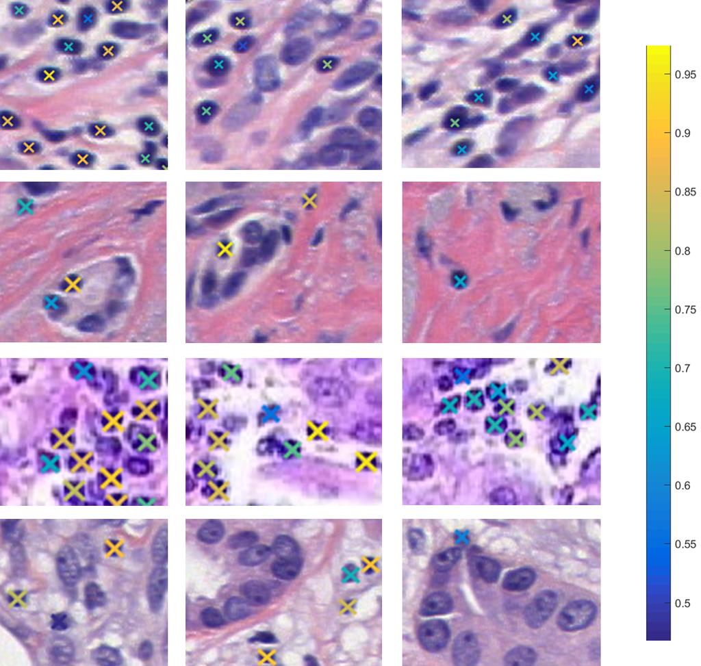 Fig. 4. Detection results on different H&E images. Row 1 is an image where considerable amount of lymphocyte exist. Row 2 is an image of a sample with lots of connected tissues.