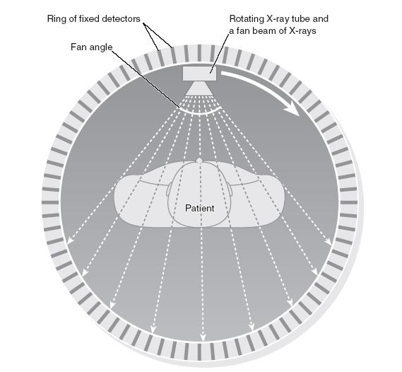 Instrumentation 4 th generation systems Fan beam: equiangular geometry 1 wide fan beam source complete ring of detectors