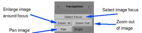 Animation (cine mode) The two buttons at each side of the Navigation label can be used to scroll automatically through the image sequence: the left button displays the previous slices, while the