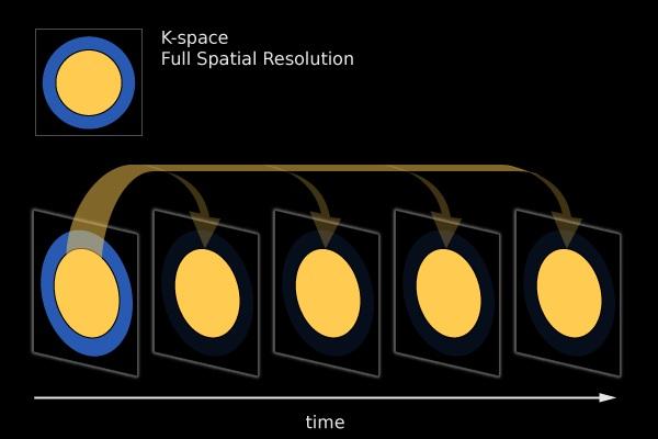 Keyhole imaging Keyhole imaging is a method used to achieve better temporal resolution without sacrificing spatial resolution.