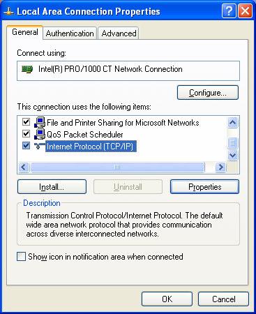 In the "Local Area Network Connection Properties" window, on the "General" tab, highlight "Internet Protocol (TCP/IP) in the "This connection uses the following items" window.