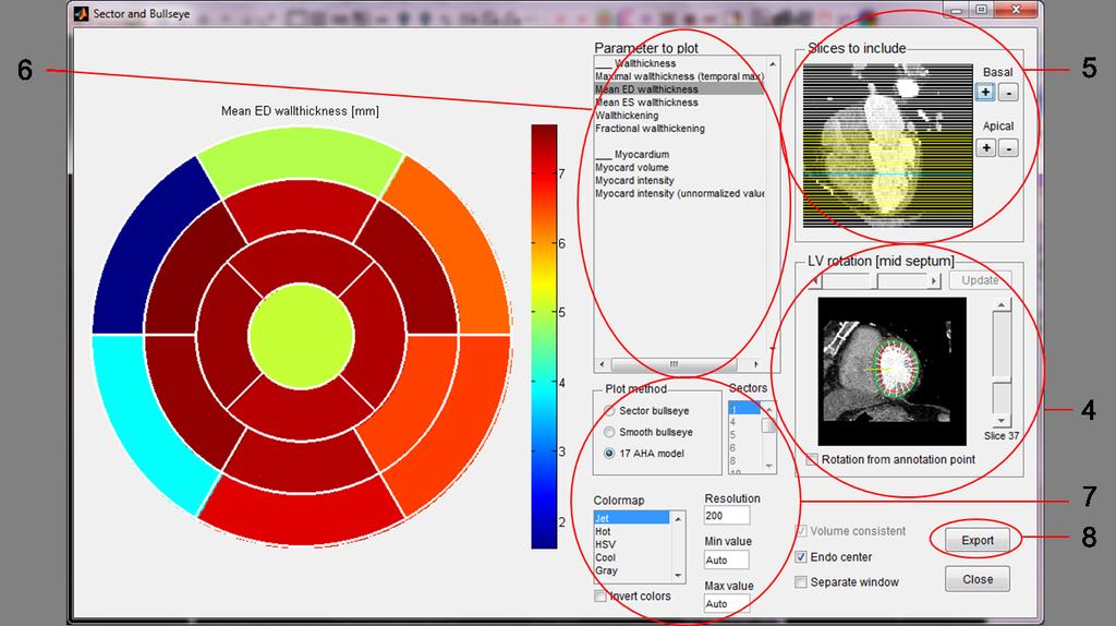 Figure 21: Bullseye analysis GUI. 4. Set the slice rotation by dragging the slider so the yellow line is in the middle of septum. Click on Update.