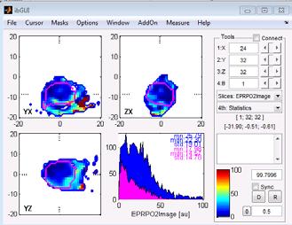 EPR Transfer tumor area from MRI to EPR po 2 image Obtain