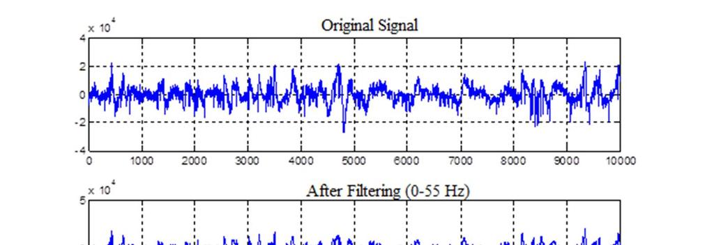 i-eeg: A Software Tool for EEG Feature Extraction, Feature Selection and Classification 3.2 Cleaning of EEG Data and Filtering MATLAB programming language were used during the preparation of EEG data.