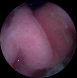 WIRELESS CAPSULE ENDOSCOPY IMAGE CLASSIFICATION BASED ON VECTOR SPARSE CODING Tao Ma 1, Yuexan Zou 1 *, Zhqang Xang 1, Le L 1 and Y L 1 ADSPLAB/ELIP, School of ECE, Pekng Unversty, Shenzhen 518055,